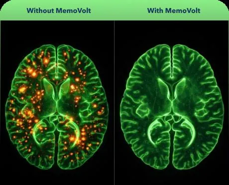 MemoVolt before and after brain support illustration